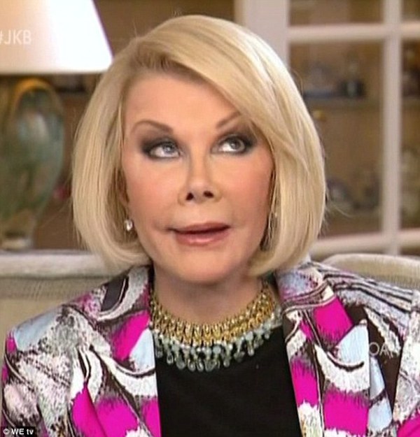 joan rivers eyelift eyeroll